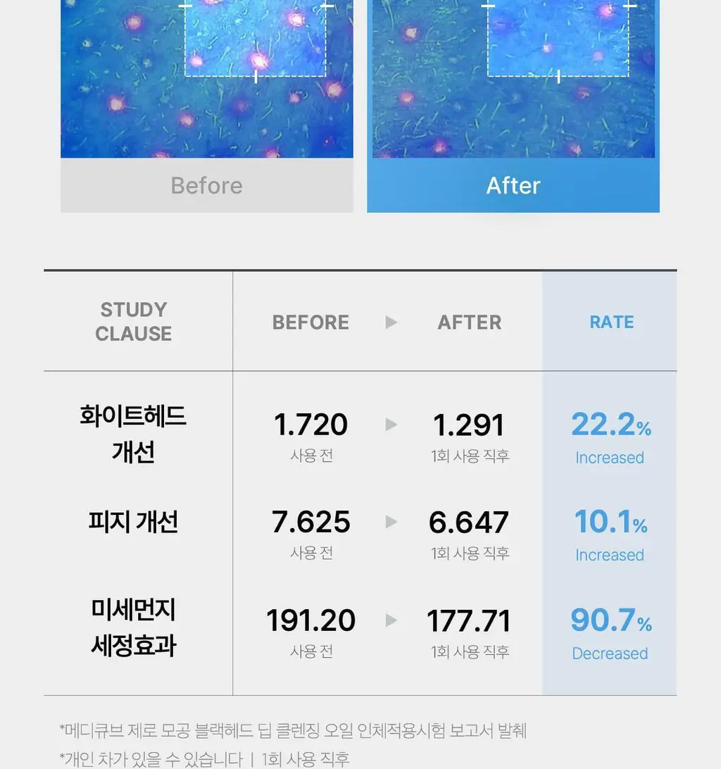[블랙헤드 제거] 메디큐브 제로 모공 블랙헤드 딥 클렌징오일 205ml 상세페이지 22